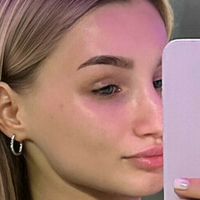 Алиша Алхимова Голе