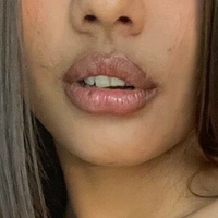 алофџена Голе