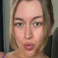 БејбиСи Голе