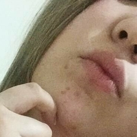 Беатрис Томасети Голе