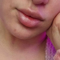 Бликси Голе