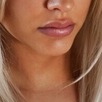 Еммастокингс Голе