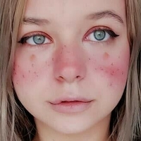 Хурона Ролера Голе