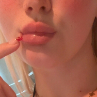 ленайнкфит Голе