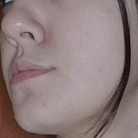 мар.децурнекс Голе