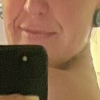 Нотсопоси Голе