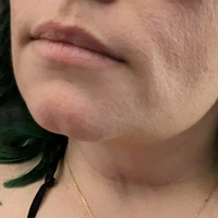 ридс_евривер Голе