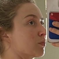 Супорсоник_ Голе