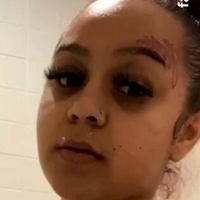 тренчбарби Голе